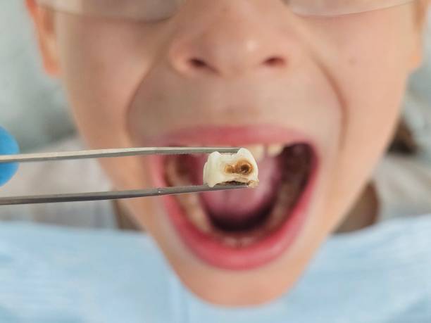 Best Broken or Cracked Tooth Emergency Dentist in Palmhurst, TX